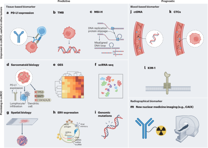 Biomarker-informed care for patients with renal cell carcinoma