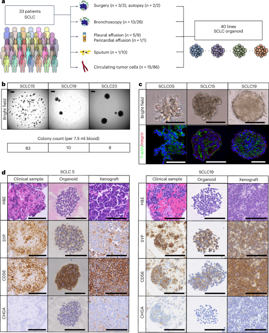 An organoid library unveils subtype-specific IGF-1 dependency via a YAP–AP1 axis in human small cell lung cancer
