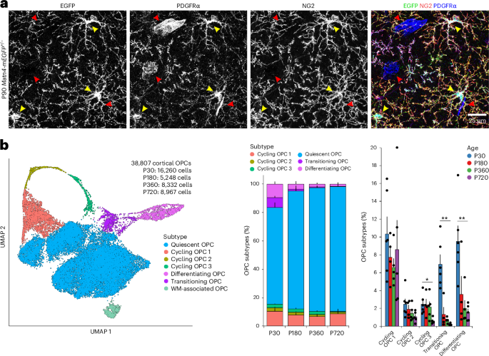 Pathways that limit differentiation of oligodendrocyte progenitors in the aging brain