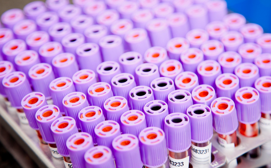 Sensitive New Test Detects Cell-Free RNA
