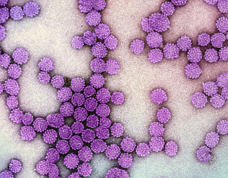 Human & HPV Genes Can Combine to Boost Cancer Growth