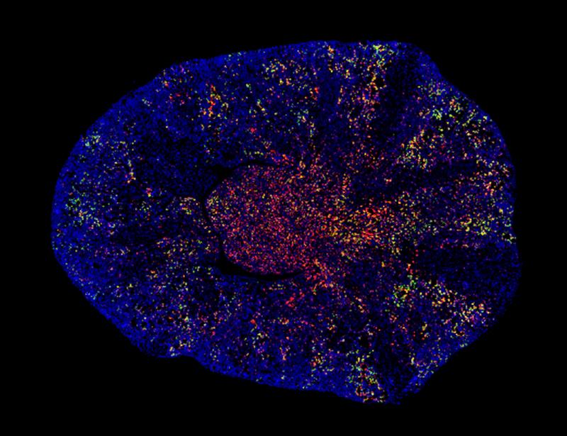 Collagen V regulates renal function after kidney injury and can be pharmacologically targeted to enhance kidney repair in mice | Science Translational Medicine