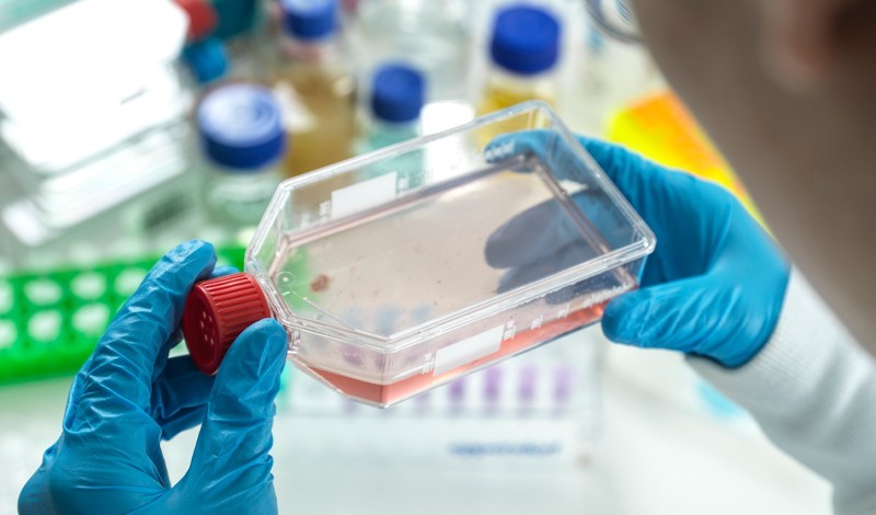 Progress with stem cell therapy in Parkinson’s disease