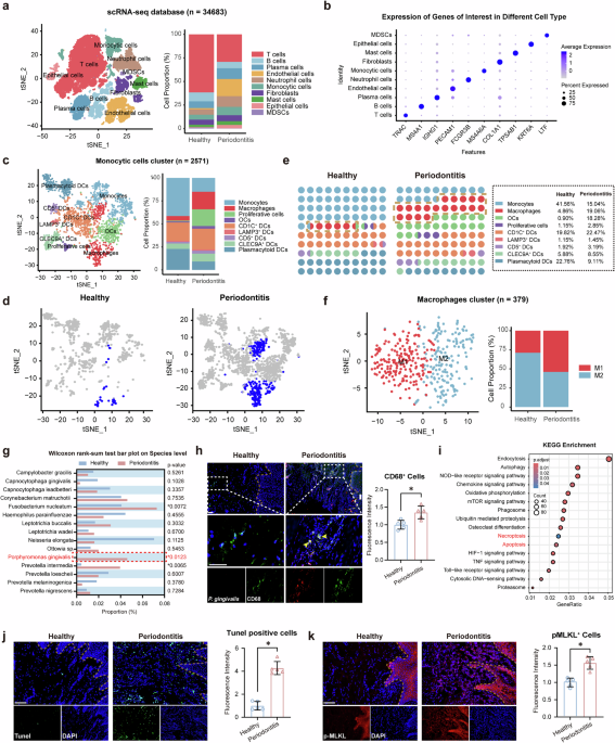 Porphyromonas gingivalis induces Zbp1-mediated macrophages PANoptosis in periodonitis pathophysiology