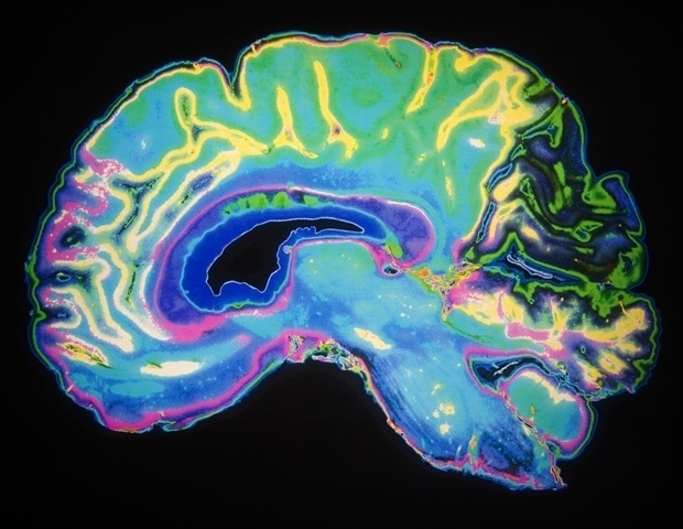 Basal ganglia neurons precisely regulate complex movement timing