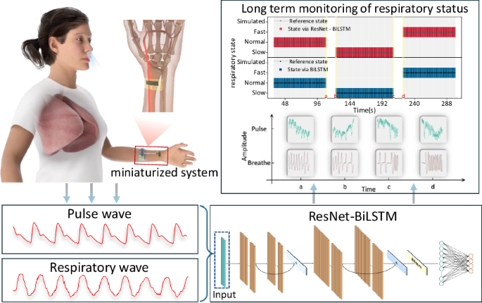 Direct extraction of respiratory information from pulse waves using a finger-inspired flexible pressure sensor system