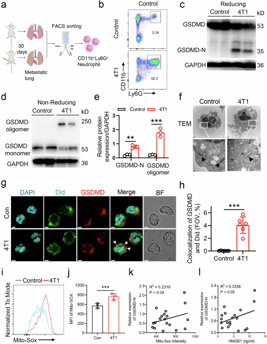 Mitochondrial reactive oxygen species promote cancer metastasis and tumor microenvironment immunosuppression through gasdermin D