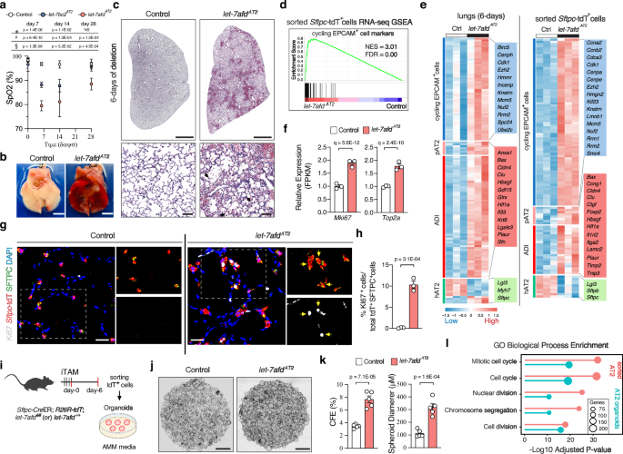 Let-7 restrains an epigenetic circuit in AT2 cells to prevent fibrogenic intermediates in pulmonary fibrosis