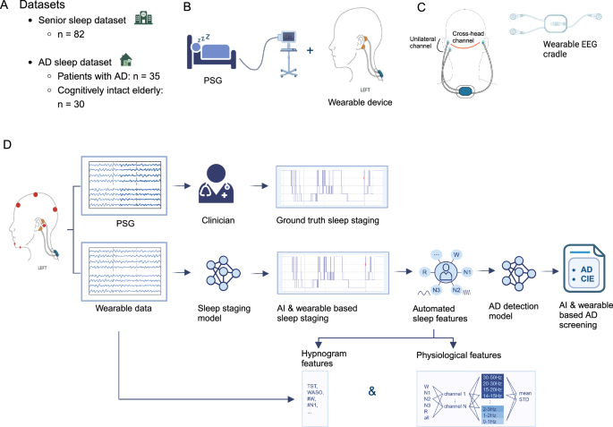 Wearable sleep recording augmented by artificial intelligence for Alzheimer’s disease screening