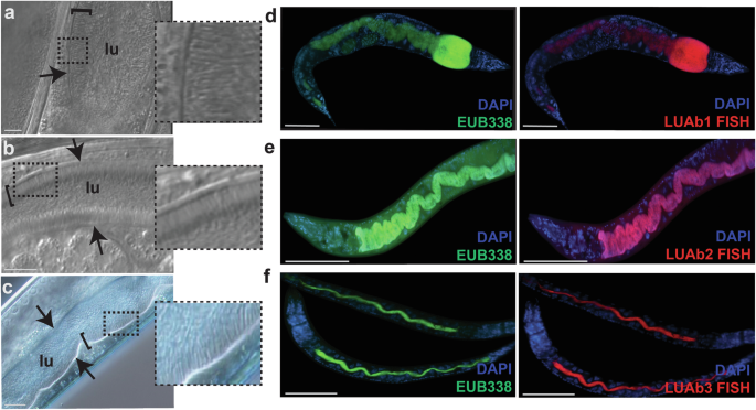 Dynamics of gut colonization by commensal and pathogenic bacteria that attach to the intestinal epithelium