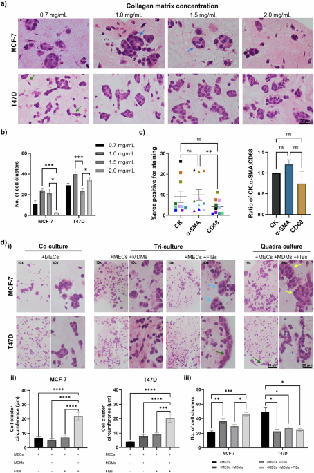 Development and characterisation of a novel 3D in vitro model of obesity-associated breast cancer as a tool for drug testing