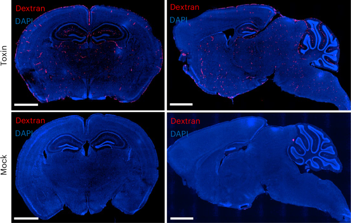 How Salmonella Typhi’s typhoid toxin causes encephalopathy