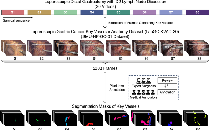 Dynamic key vascular anatomy dataset for D2 lymph node dissection during laparoscopic gastric cancer surgery