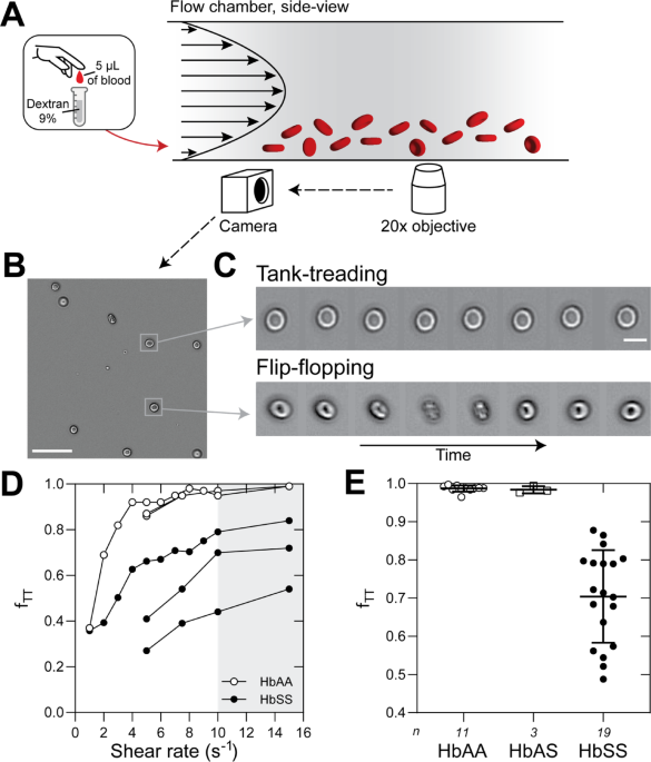 A novel red blood cell deformability biomarker is associated with hemolysis and vaso-occlusive crises in sickle cell disease