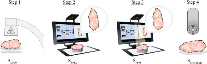 Real-time peri-operative microcalcification detection in superficial breast tissues