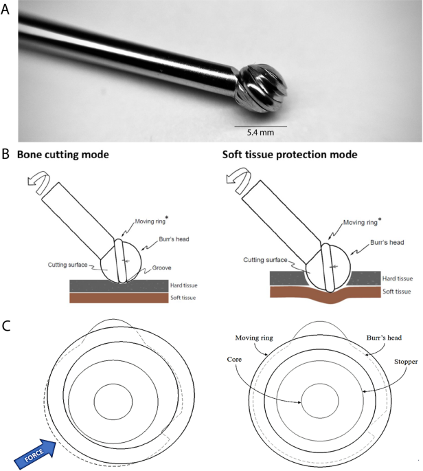 Evaluation of a novel high speed burr tip for safe and efficient bone surgery in a sheep model