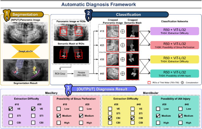 Automated diagnosis for extraction difficulty of maxillary and mandibular third molars and post-extraction complications using deep learning