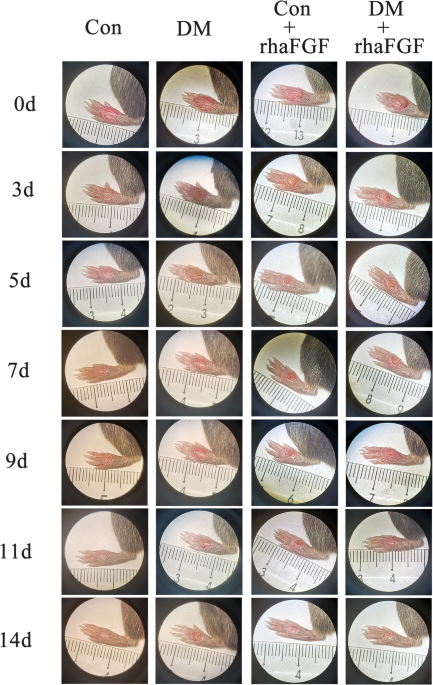 rhaFGF promotes acute diabetic wound healing by suppressing chronicity of inflammation