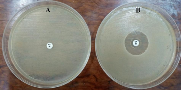 Mycosynthesis of zinc oxide nanoparticles using Mucor racemosus with their antimicrobial, antibiofilm, anticancer and antioxidant activities