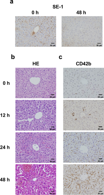 Platelet aggregation elicits FasL expression and hepatocyte apoptosis in sinusoidal obstruction syndrome