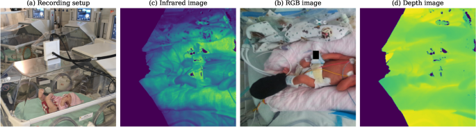 Continuous non-contact vital sign monitoring of neonates in intensive care units using RGB-D cameras