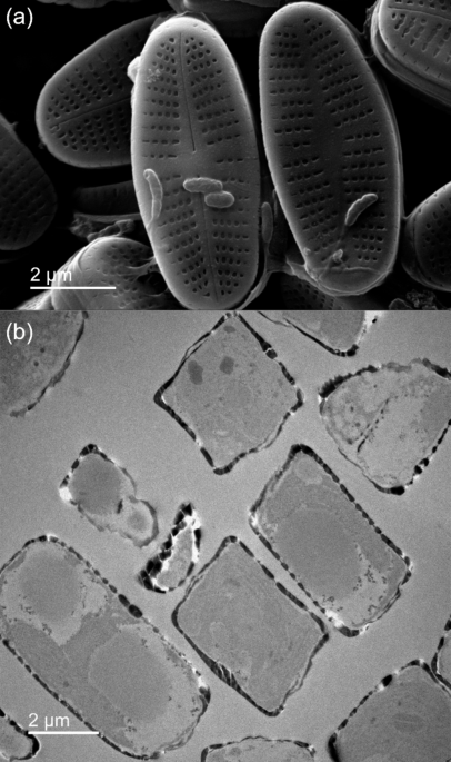 A multiscale investigation of uranium(VI) interaction with a freshwater diatom species