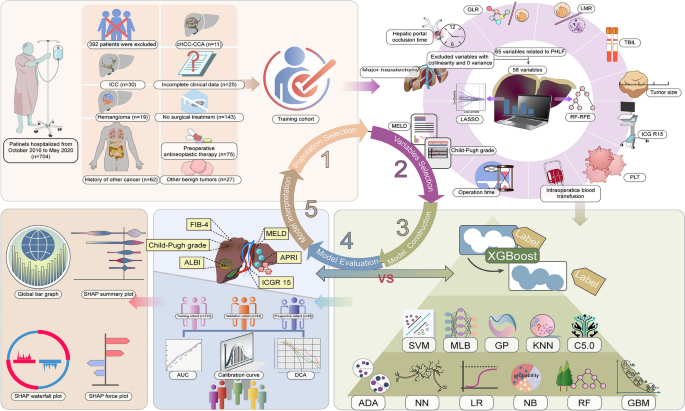 Interpretable machine learning model for predicting post-hepatectomy liver failure in hepatocellular carcinoma