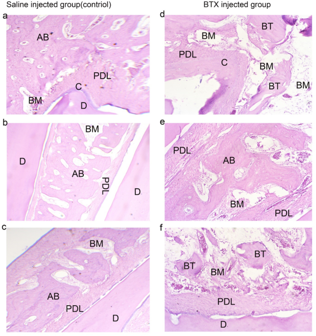 Effect of botulinum toxin type A on masticatory function and musculoskeletal structure in rabbits