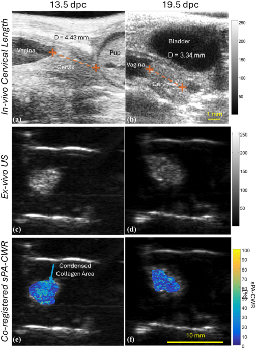 Multi-parametric quantitative evaluation of murine cervical remodeling during pregnancy and postpartum