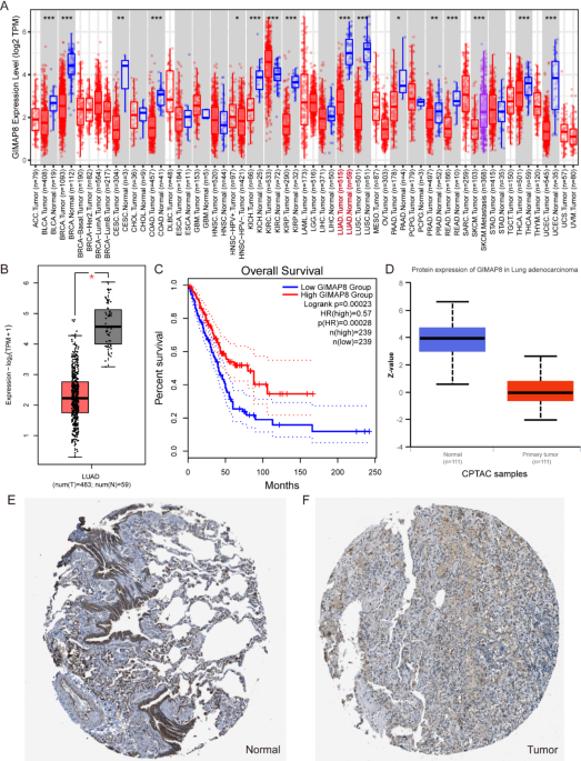 GIMAP8 could serve as a potential prognostic factor for lung adenocarcinoma and is closely related to immunity