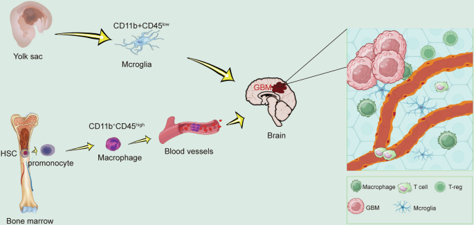 Exploring tumor-associated macrophages in glioblastoma: from diversity to therapy