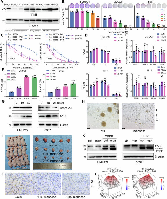 Mannose inhibits PKM2 lactylation to induce pyroptosis in bladder cancer and activate antitumor immune responses