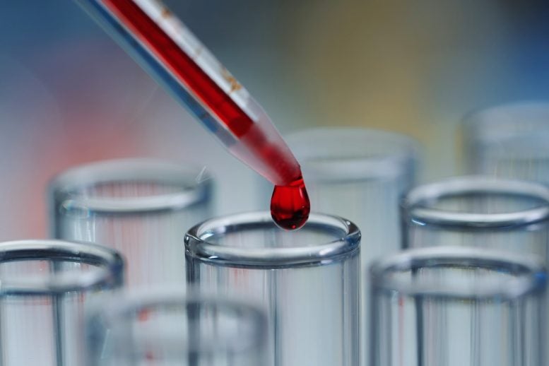 USC Scientists Unveil 5-in-1 Blood Test for Early Alzheimer’s Detection