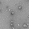 New nanoparticle weapon in the fight against cardiovascular and kidney disease