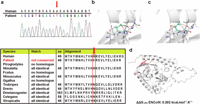 Allogenic mitochondria transfer improves cardiac function in iPS-cell-differentiated cardiomyocytes of a patient with Barth syndrome
