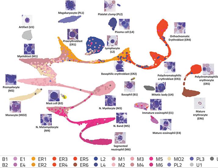 DeepHeme, a high-performance, generalizable deep ensemble for bone marrow morphometry and hematologic diagnosis | Science Translational Medicine
