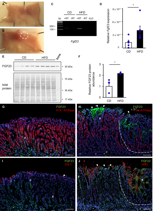 High fat diet induces gastric production of fibroblast growth factor 23 (FGF23)