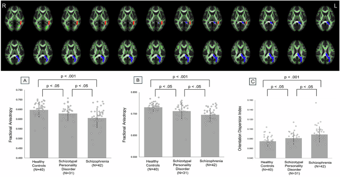 Investigation of brain white matter and social cognition in schizophrenia and schizotypal personality disorder using neurite orientation dispersion and density imaging