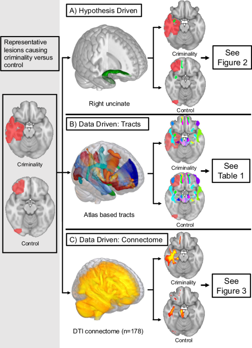 White matter disconnection in acquired criminality