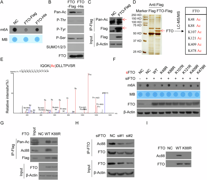 K88 acetylation of FTO increases its RNA m6A demethylation and promotes tumorigenesis