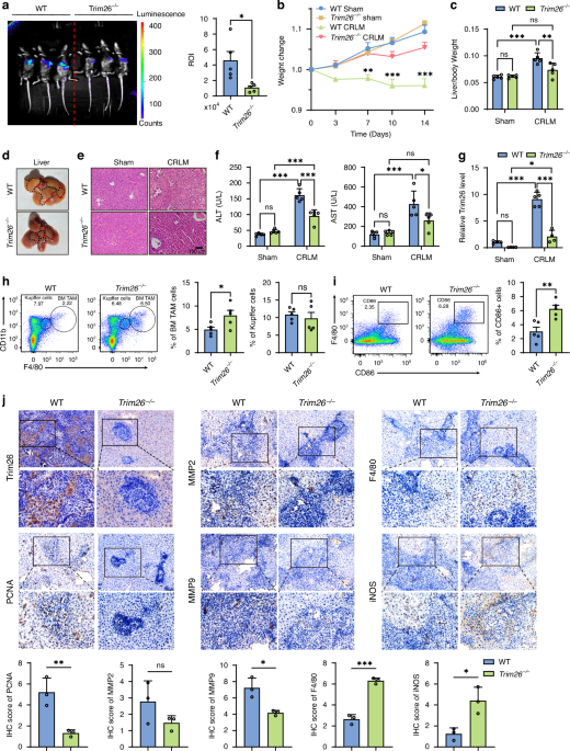 TRIM26 deficiency potentially suppresses colorectal cancer liver metastasis through NF-κB-mediated M1-like tumor-associated macrophage polarization