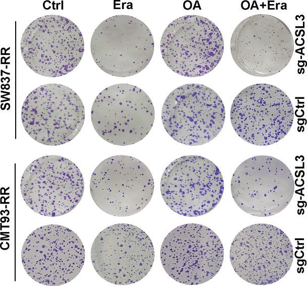 Correction: Monounsaturated fatty acids promote cancer radioresistance by inhibiting ferroptosis through ACSL3