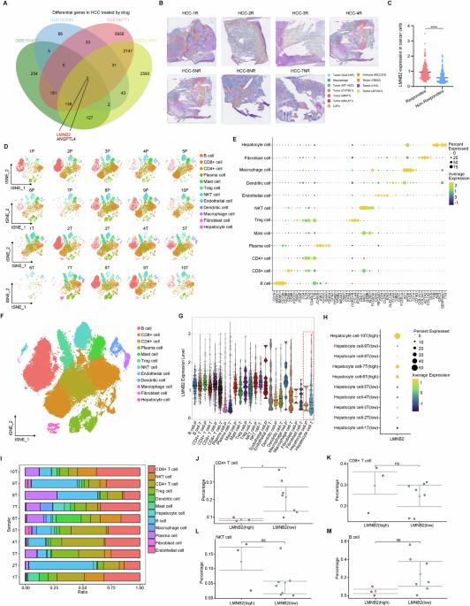 LMNB2-mediated high PD-L1 transcription triggers the immune escape of hepatocellular carcinoma