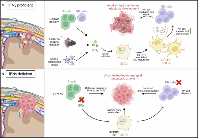 CNS gatekeepers: IFNγ-activated dendritic cells control leptomeningeal metastasis