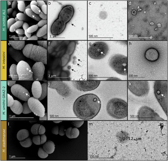 Proteomic and metabolomic profiling of extracellular vesicles produced by human gut archaea