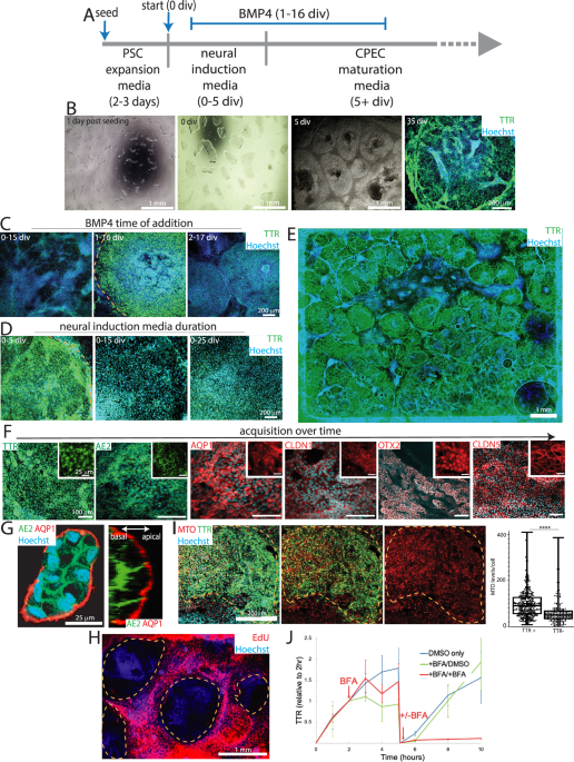 Sequential emergence and contraction of epithelial subtypes in the prenatal human choroid plexus revealed by a stem cell model