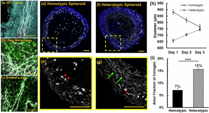 Stroma content in triple-negative breast cancer spheroid models regulates penetration and efficacy of tumor-targeting Salmonella typhimurium
