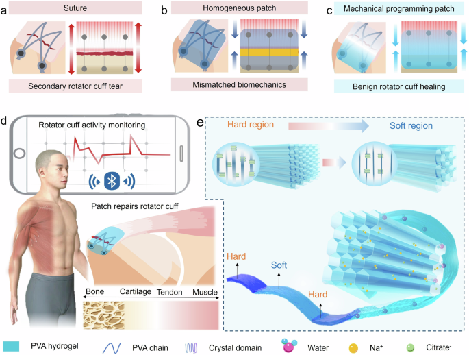 High-strength mechanically gradient hydrogels via physical crosslinking for tendon-mimetic tissue repair