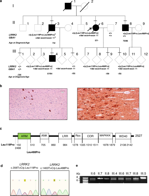 A new LRRK2 variant in a family with Parkinson’s disease affects binding to RAB8A