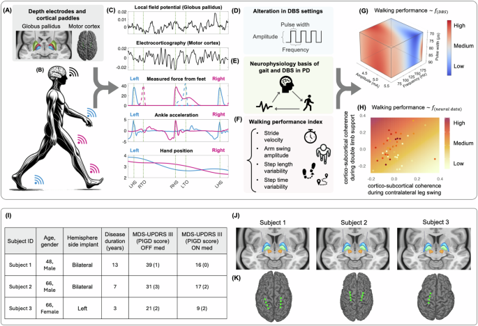 Modeling and optimizing deep brain stimulation to enhance gait in Parkinson’s disease: personalized treatment with neurophysiological insights